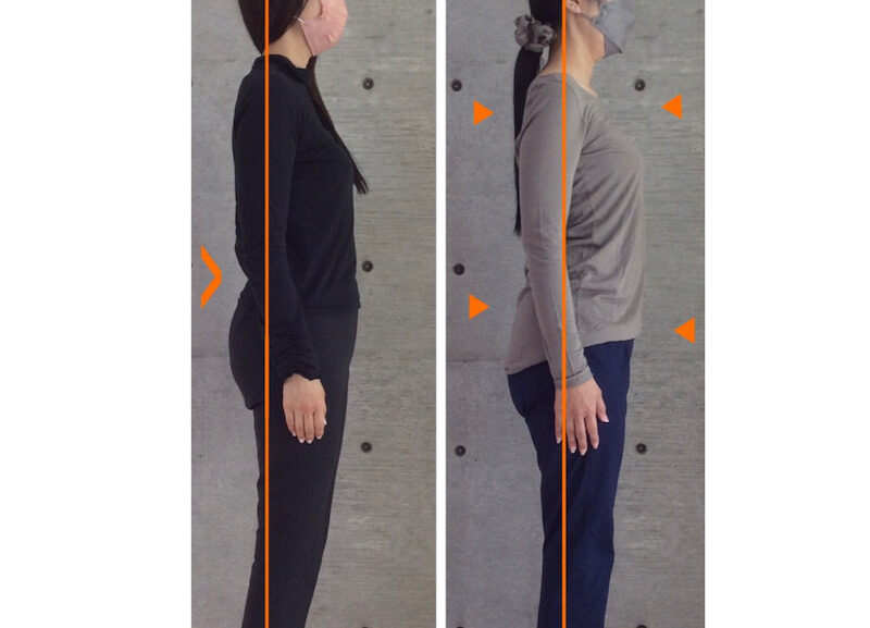 ぎっくり腰も姿勢改善で解消できる!?ぎっくり腰になる原因と解消方法をご紹介。