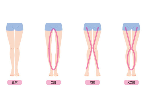 O脚に悩む女性へ：原因と改善方法を徹底解説。