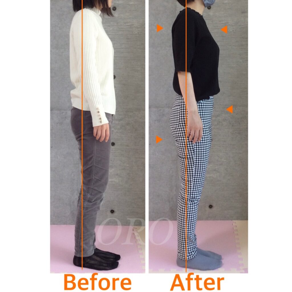 姿勢についてのビフォーアフター写真